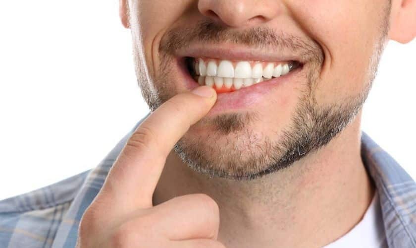 Featured image for “Healthy Gum Tips From a Periodontist”