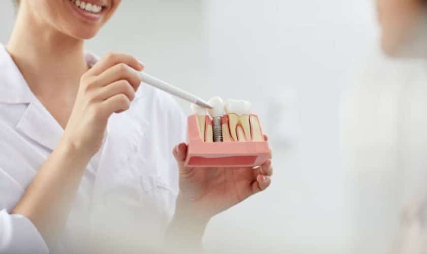 Featured image for “Tips On Preparing For a Bone Graft For Dental Implants”