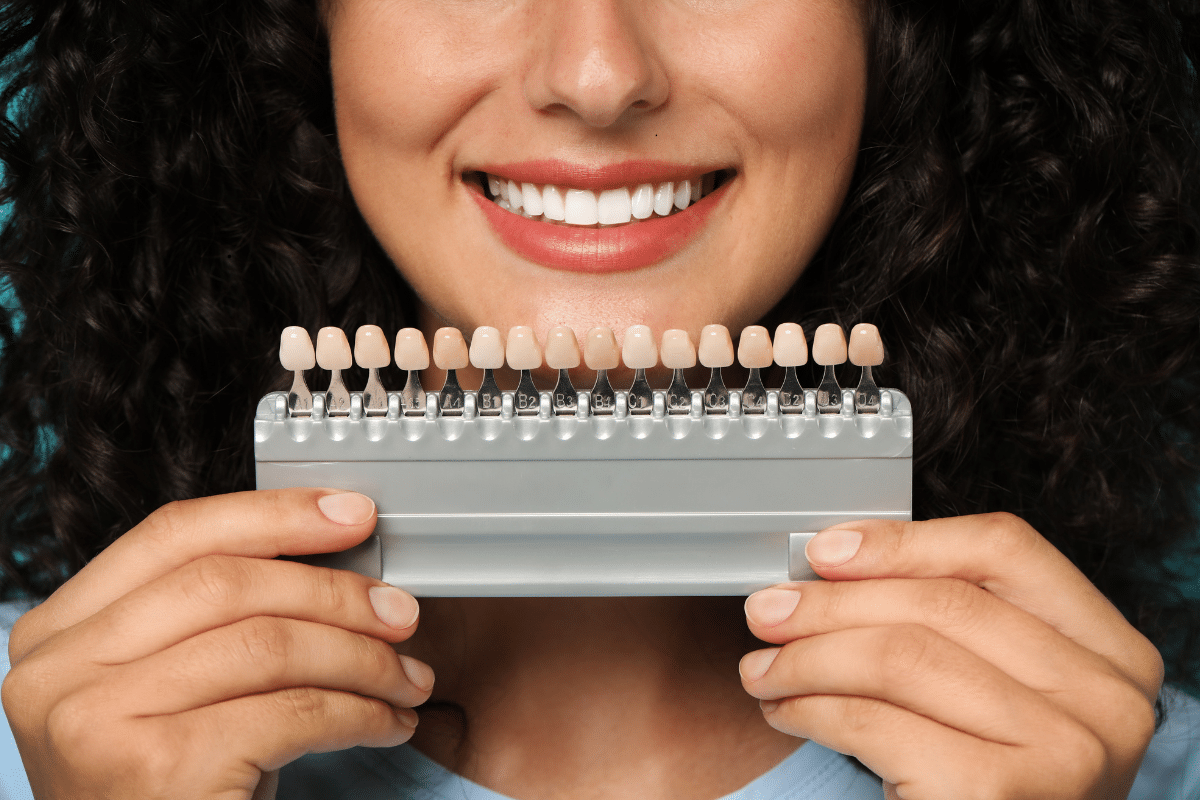 Featured image for “Your Complete Guide to Getting Veneers for a Stunning Smile”