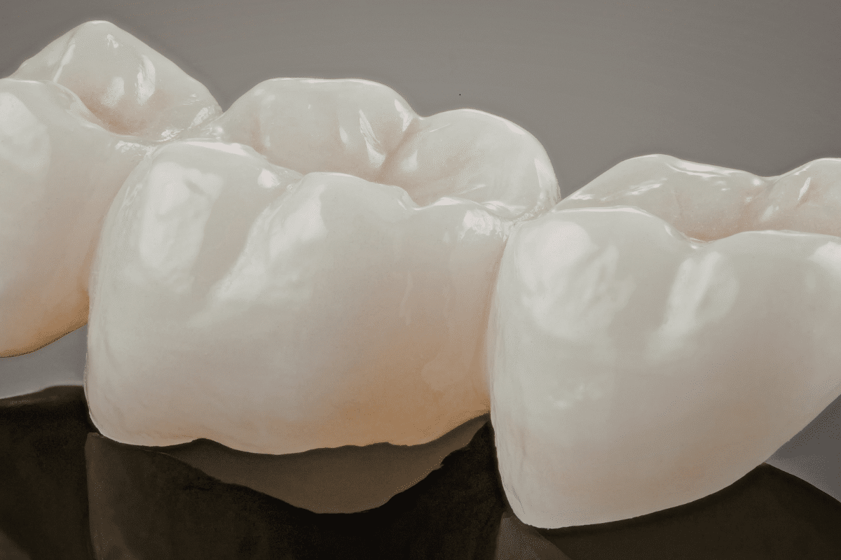 Featured image for “Four Reasons a Dental Crown Could Save Your Smile”