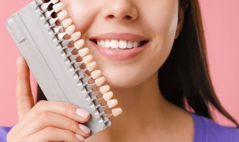 Featured image for “The Ultimate Veneers FAQ: Answers to Your Top Questions”