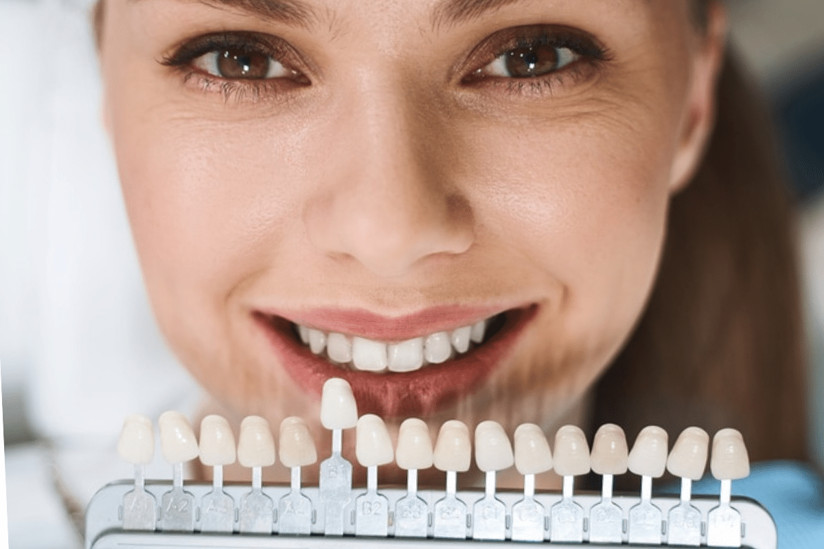 Featured image for “Tips for Choosing the Perfect Shade for Your Dental Veneers”