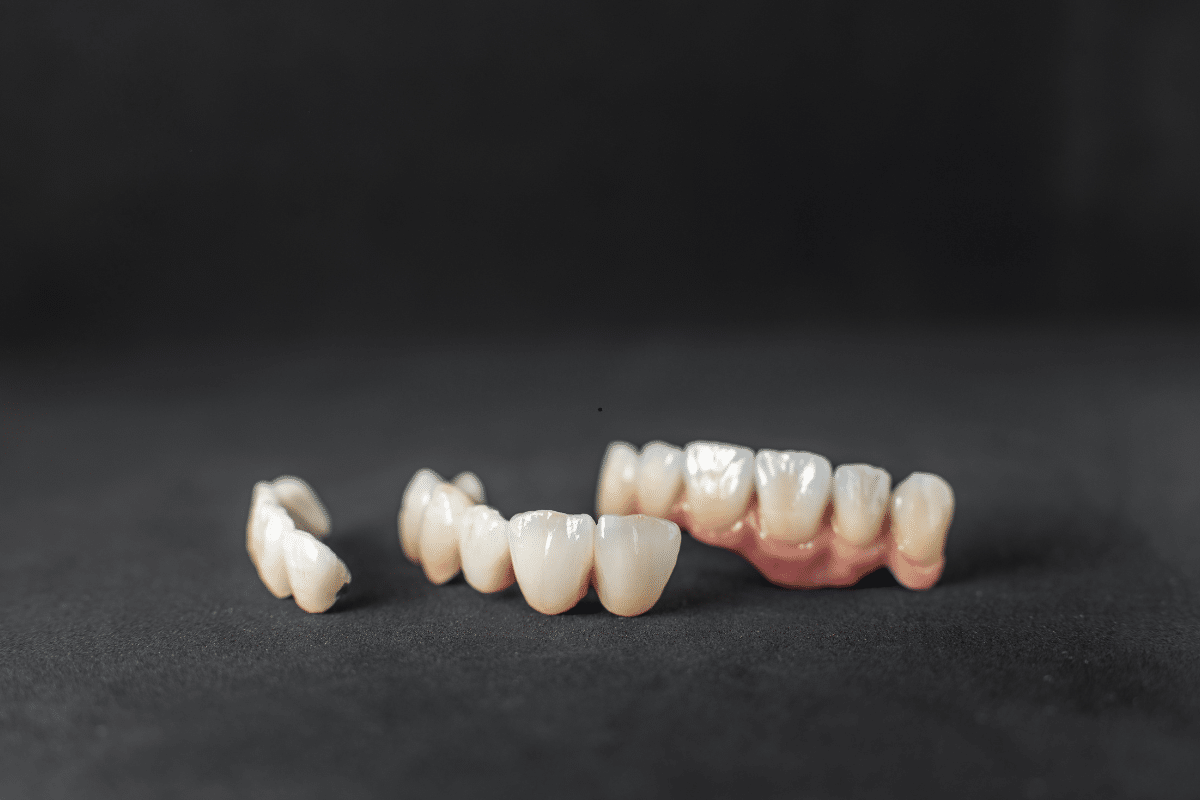 Featured image for “Smile Transformation: Exploring Minimally Invasive Veneers”