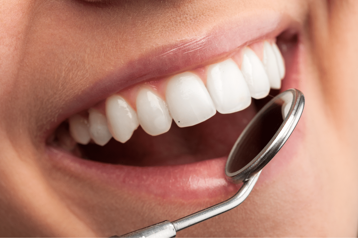 Featured image for “Your Smile’s Next Step: What to Expect After the Dentist Visit”