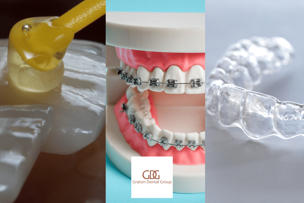 Featured image for “Veneers, Braces, or Invisalign: Which Smile Solution Is Right for You?”