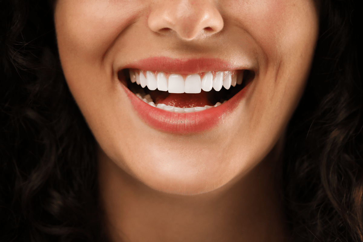 Featured image for “Can You Whiten Your Teeth If You Have Crowns or Veneers?”