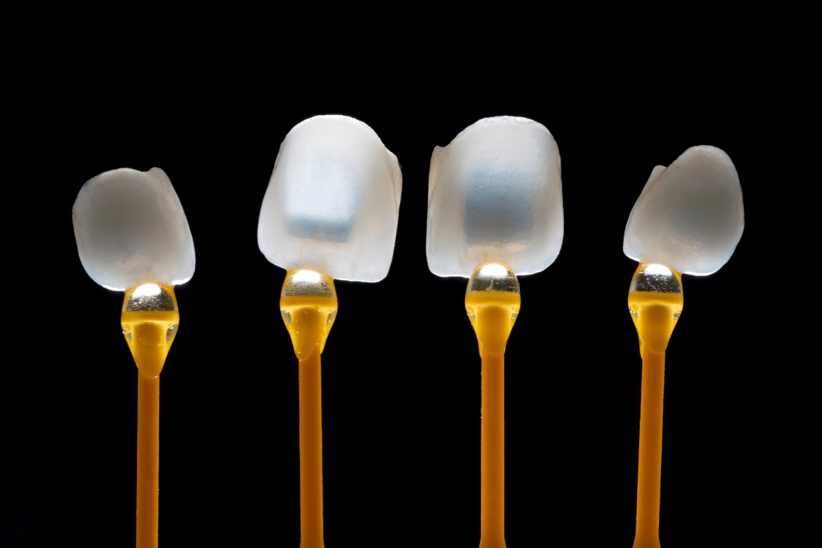 Featured image for “The Latest Veneer Trends for 2025–2026: Colors, Shapes, and Natural Styles Patients Love”