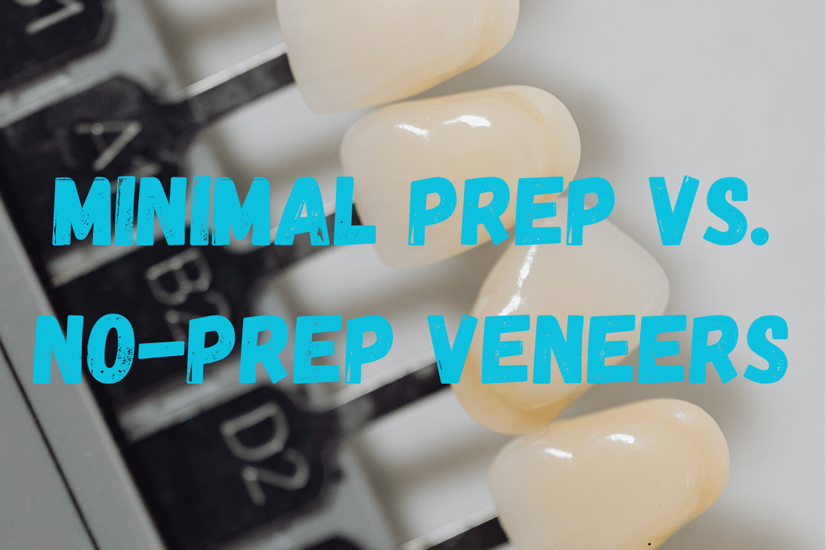 Featured image for “Minimal Prep vs. No-Prep Veneers: How Much of Your Natural Enamel Should You Preserve?”